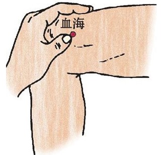 或有功能性出血,艾灸时要加“隐白穴”,效果较好.