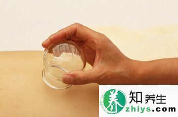 拔罐养生